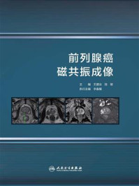 前列腺癌磁共振成像/王建业